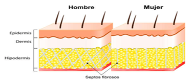 dibujo celulitis