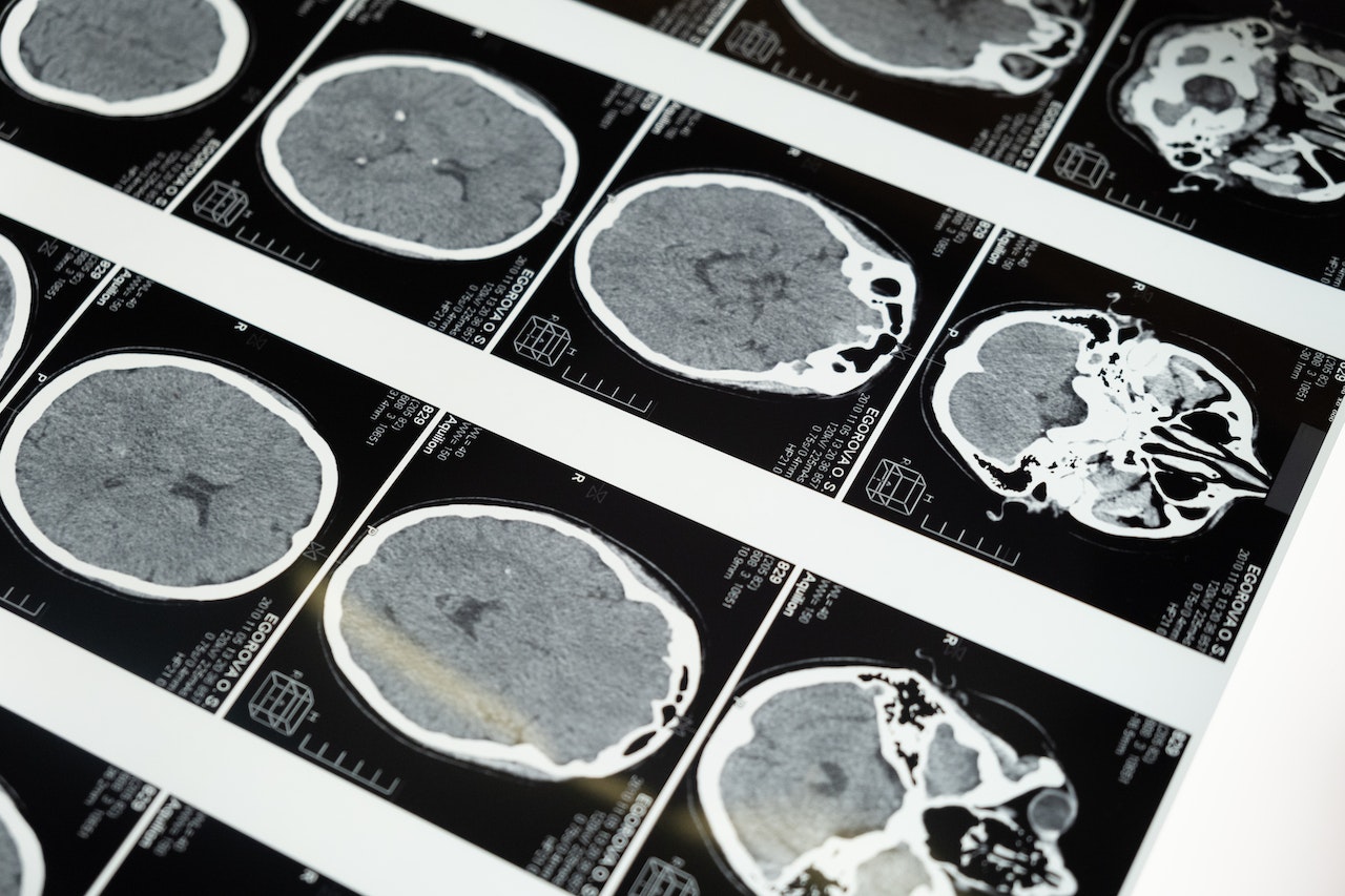neuroliderazgo