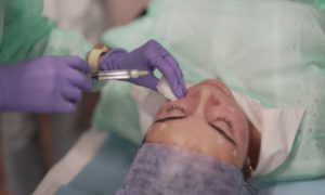 tratamiento dermoestética