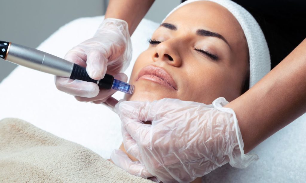 microneedling-dermapen
