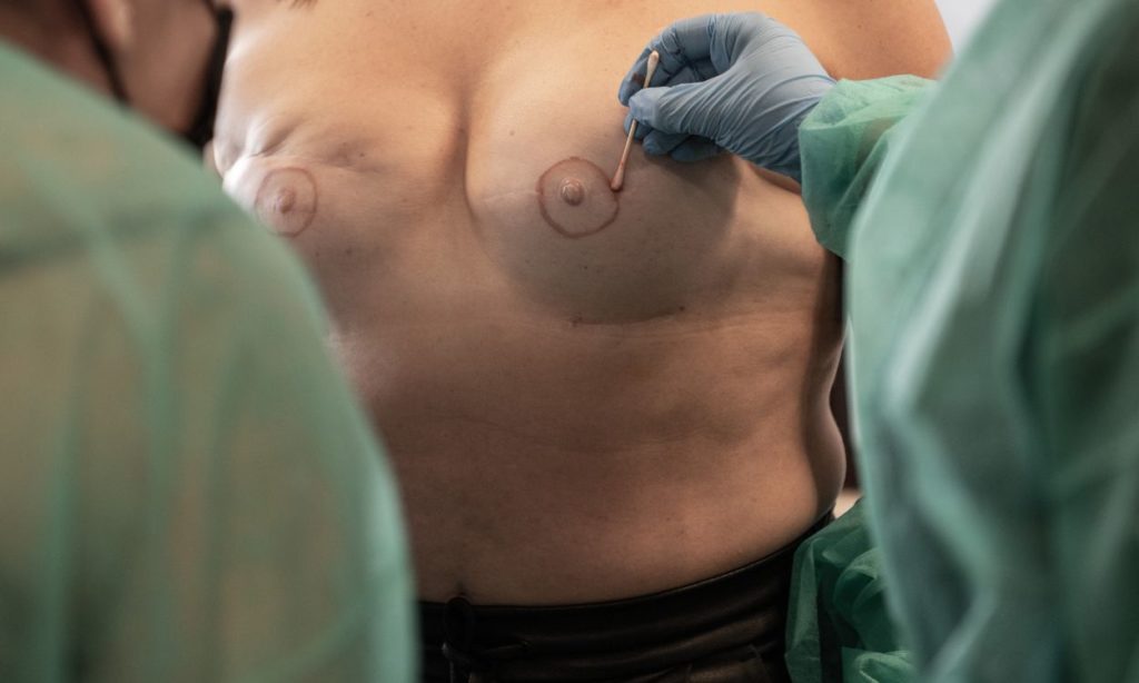 Estudio areola en Curso de Micropigmentación Areolar