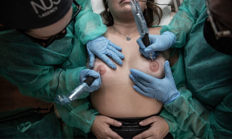 Técnica de micropigmentación areolas en curso micropigmentación de. areolas para enfermeras