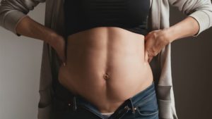 imagen-destacada-fisisoterapia-tratamiento-diastasis-recto-anterior