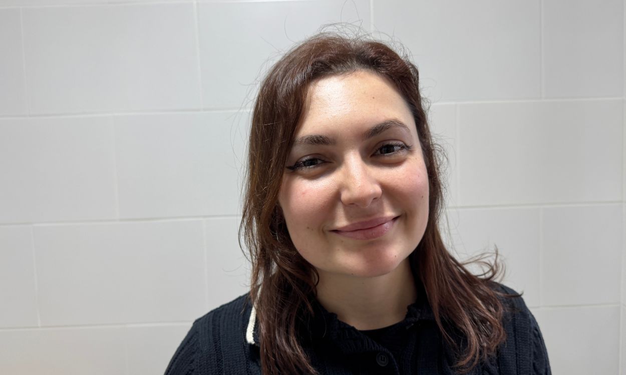 sara barberán alopecia androgénica femenina