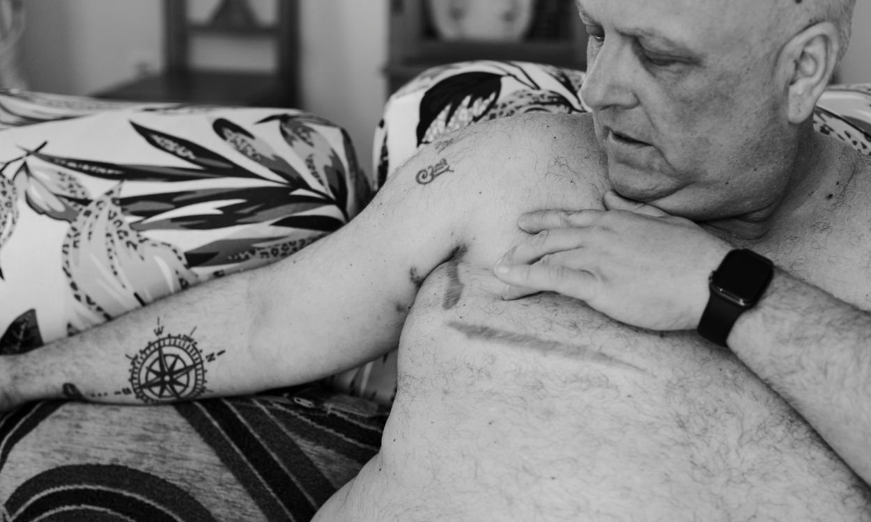 Asociación INVI cáncer de mama masculino
