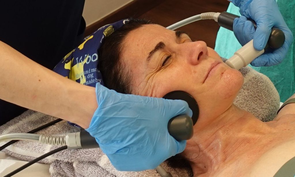 bichectomia-alternativa-no-invasiva-radiofrecuencia-capenergy-medical
