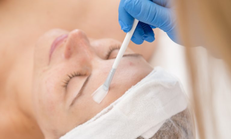 portada-blog-tipos-de-peeling-quimicos-para-el-acne-son-los-mas-adecuados