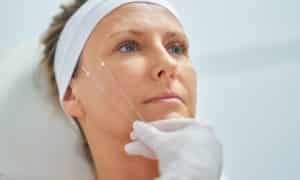 imagen-destacada-diferencias-clave-hilos-PDO-hilos-espiculados